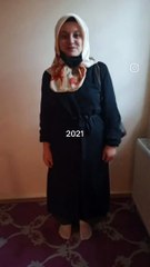 Genç Bir Kızın 3 Yıllık Değişimi Görenleri Şaşırttı