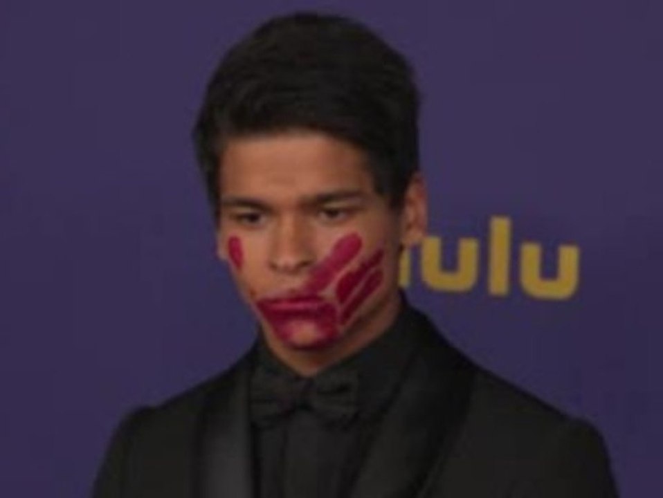 Emmy Awards: 'Reservation Dogs'-Star setzt Zeichen mit 'blutiger' Hand