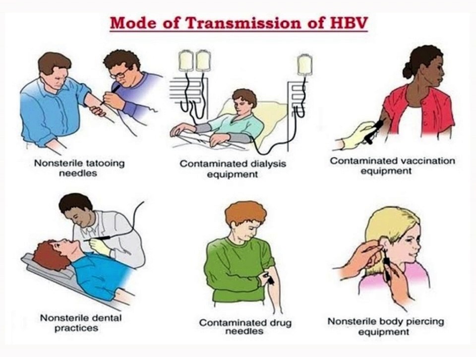 Hepatitis B : क्या होता है हेपेटाइटिस बी , कैसे पहचानें, treatment, symptoms, diagnosis, diet