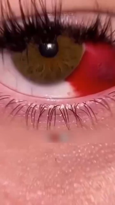 Si tu as des rougeurs