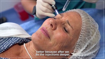 The Best Stem Cells Facial Treatment | Goodbye Wrinkle Lines