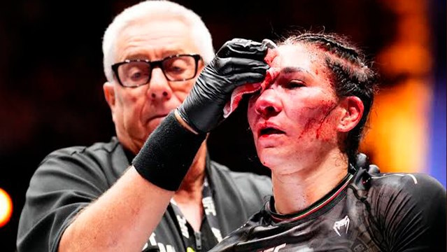 Irene Aldana comparte impresionante vídeo de su rostro tras la fuerte herida que sufrió en UFC 306