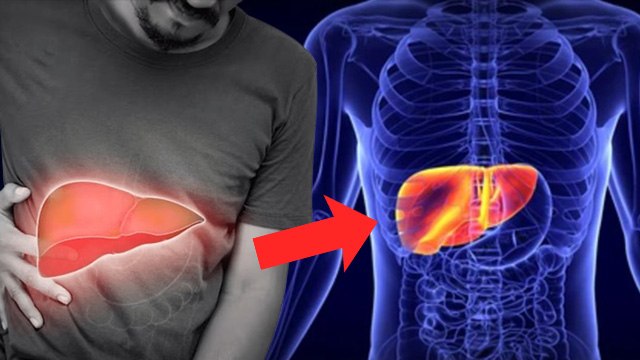 Liver Function Test Kab Karwana Chahiye | इस Disease में Liver Function Test Important क्यों