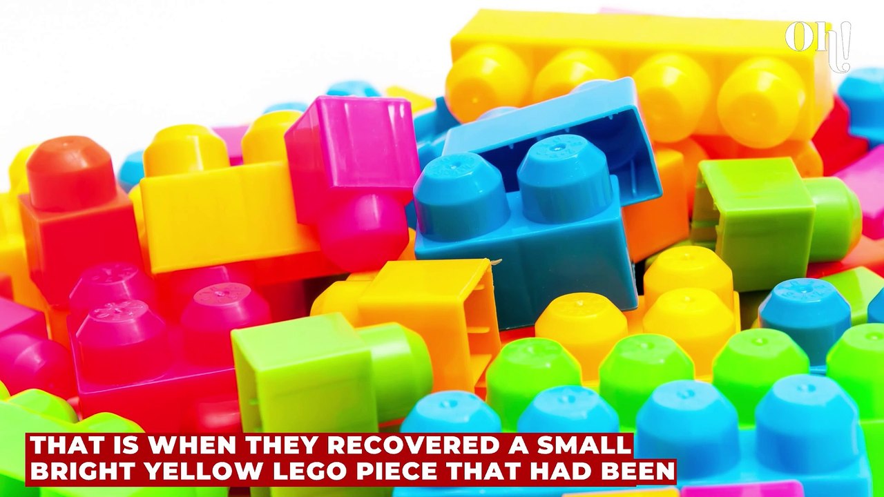 Arizonan who struggled to breathe all their life sneezes out a 25-year-old piece of Lego