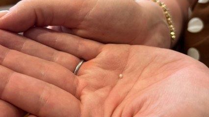 British diner shocked to find pearl inside mussel at seafood restaurant