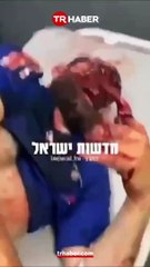 Terör devleti İsrail Lübnan’da Hizbullah’ın kullandığı çağrı cihazlarını bomba gibi patlattı