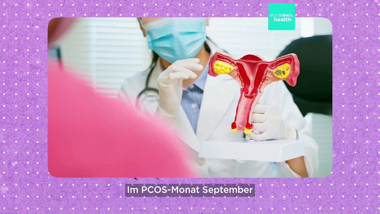 Mangelnde Forschung für PCOS: 70 Prozent der Frauen weltweit nicht diagnostiziert