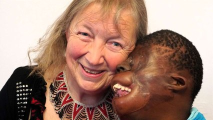 'Most burned girl to survive' finds peace in Scot village after "Brexit" abuse