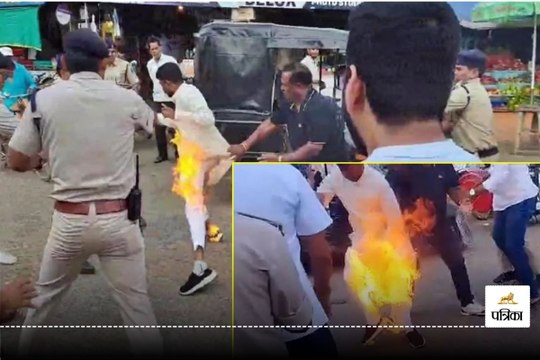 Gpm News: पुतला दहन के दौरान आग में झुलसे कांग्रेस नेता, पजामे में लग गई आग फिर... देखें Live Video