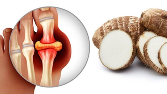 High Uric Acid Me Arbi Ki Sabji Kha Sakte Hain | Is Taro Good For Uric Acid | Boldsky