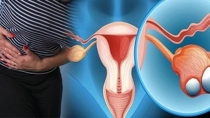 Ov-ary Size Increase Reason & Treatment: ओवरी का साइज क्यों बढ़ता है, घरेलू इलाज क्या है |Boldsky