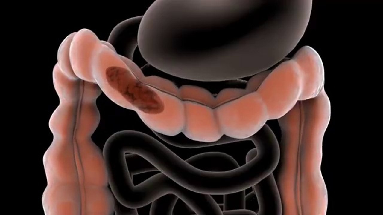 Can't Poop? 1 Easy Trick on the Toilet to Get Things Moving! Dr. Mandell