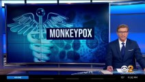 Monkeypox - Medical Experts explain abouth monkey pox