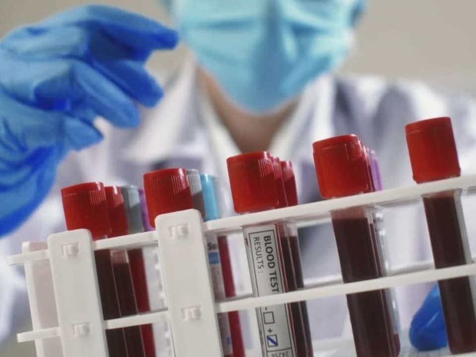 Forscher knacken 50 Jahre altes Rätsel: Neue Blutgruppe entdeckt!