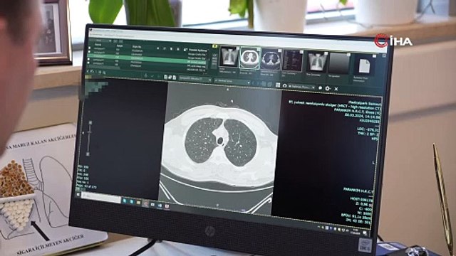 Sigarada Hile: 'Amaç katranı gizleyerek bırakmayı önlemek'