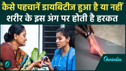diabetes symptoms: डायबिटीज से कैसे करें बचाव, ये देसी प्रयोग भी हैं काफी कारगर| वनइंडिया