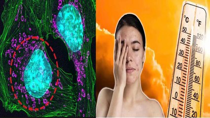 किन लोगों को Skin Cancer का खतरा सबसे ज्यादा | Skin Cancer Risk Factors In Hindi | Boldsky