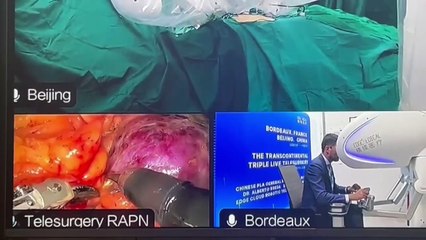 Médico opera a distancia con cirugía robótica un tumor de riñón a un paciente que estaba en Pekín