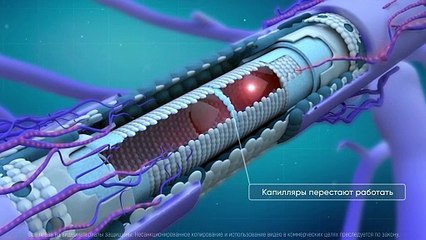 下载视频: Микросферы и здоровье. Изделия из микросфер для вашего здоровья