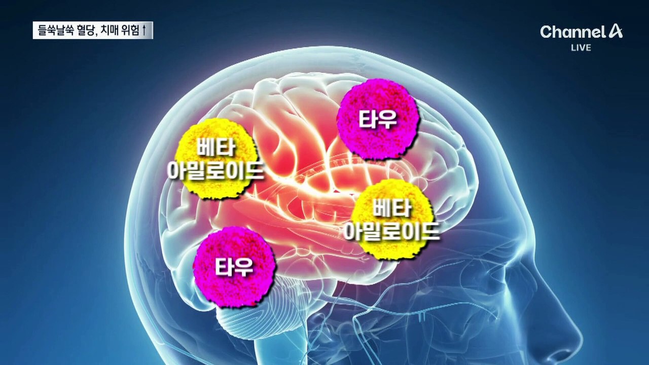 들쑥날쑥 혈당·혈압, 치매 위험 높인다