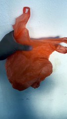 organizing recycle plastics