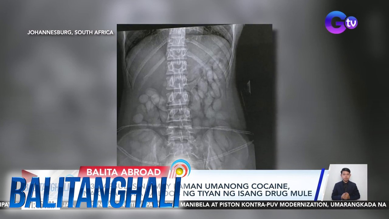63 capsules na may laman umanong cocaine, nakuha mula sa loob ng tiyan ng isang drug mule | Balitanghali