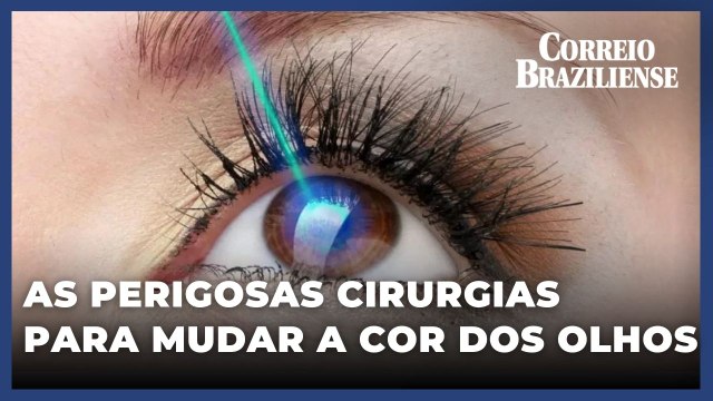 Mudança da cor dos olhos: Conheça os riscos dessa cirurgia