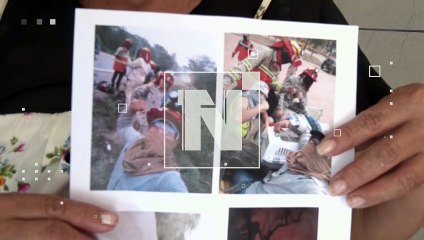 Mamá de bombero pide ayuda para su hijo que sufrió heridas combatiendo los incendios