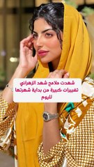 شهد الزهراني قبل وبعد التجميل