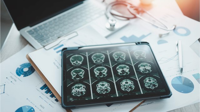 Man who had a runny nose for six years before doctors discovered he had a hole in his skull