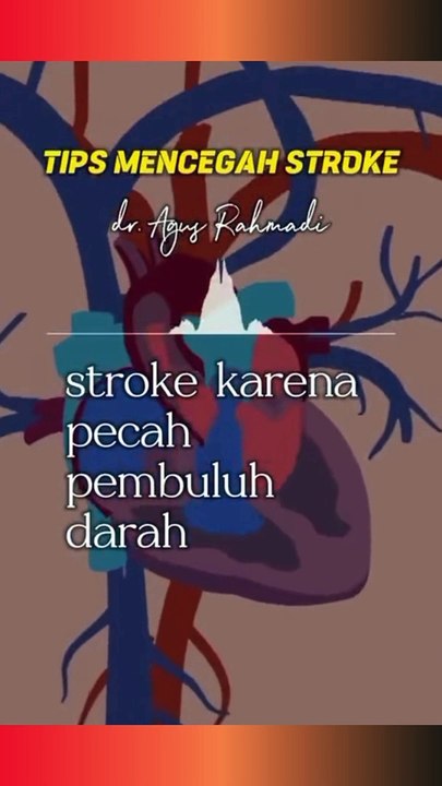2 Macam Stroke