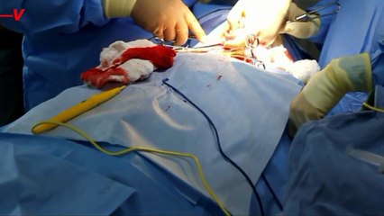 Hospital Acquired Infections Are A Big Problem That Doctors Are Trying to Deal With