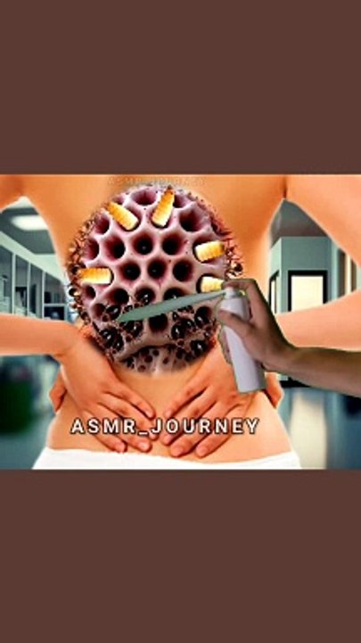 Gentle ASMR Animation ||Healing Backbone Infections" |