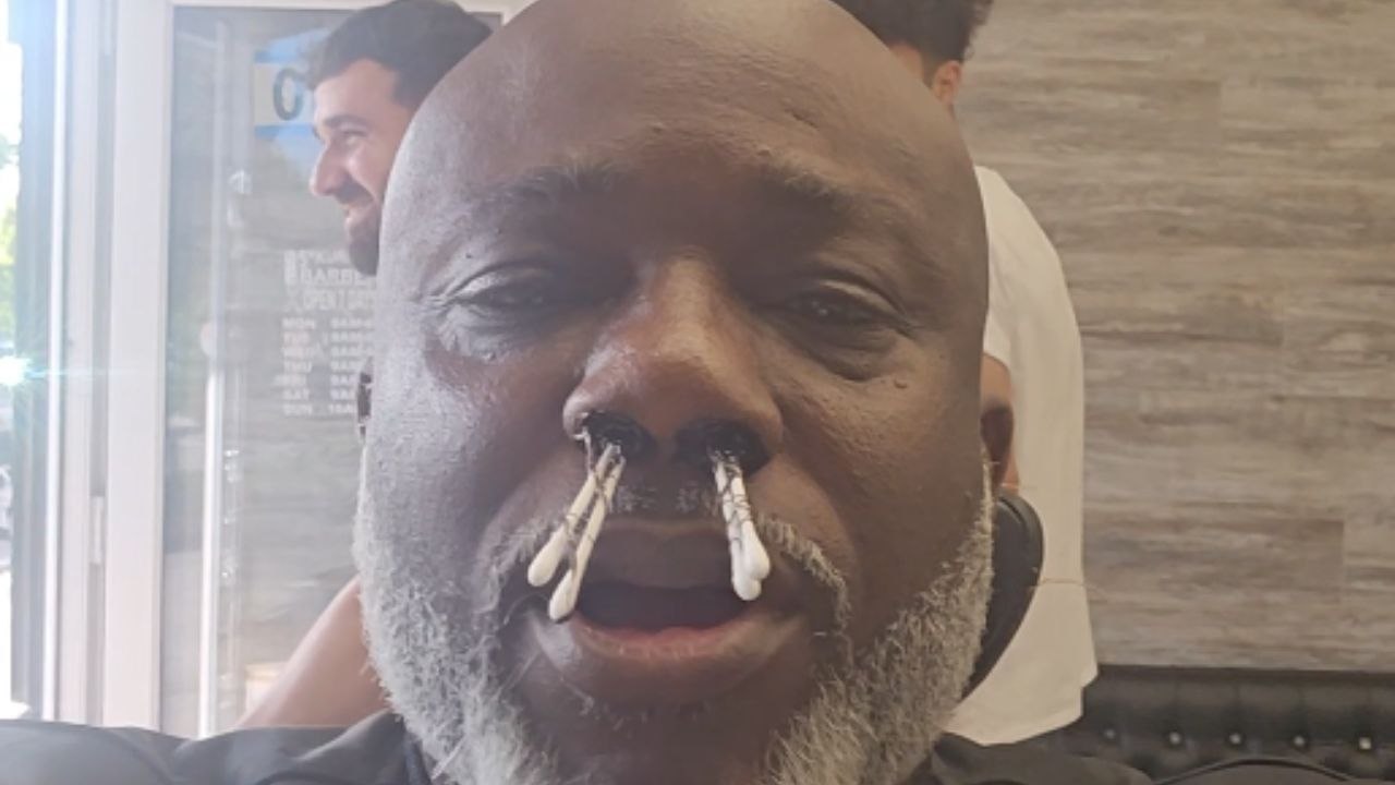 Man's first nostril hair waxing experience ended in an unexpected pain