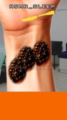 Hand infect CLEANING DUST ANIMATION 2D TREATMENT #earcleaning #asmrvideo