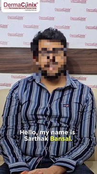 An Honest Review: Hair Transplant Testimonial in Delhi | Dr. Amrendra Kumar at DermaClinix