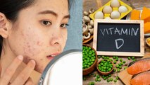 Vitamin D ki Kami Se Pimple Hote Hai Kya,Does Vitamin D Deficiency Cause Acne | Boldsky