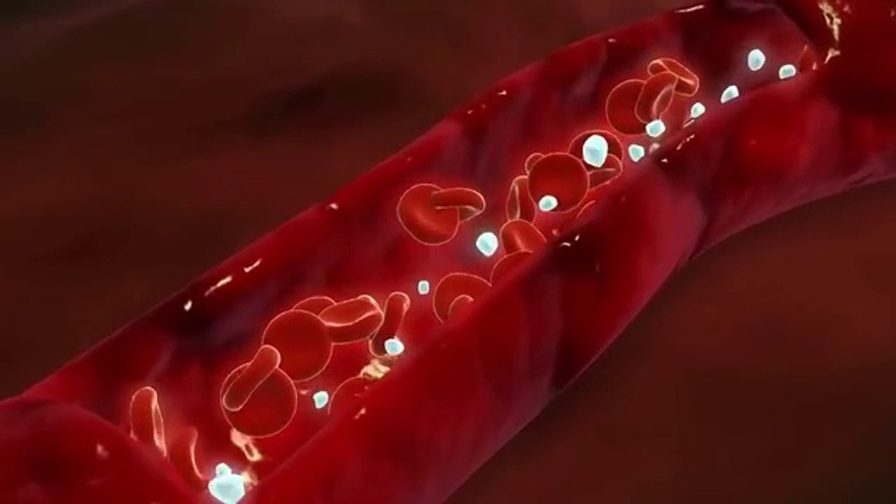 1 Tablespoon a Day...Takes Plaque, Cholesterol, and Pains Away! Dr. Mandell