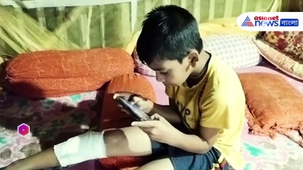 বাড়ি থেকে বেরোতে হচ্ছে লাঠি নিয়ে! শিয়ালের উপদ্রবে অতিষ্ঠ গ্রামবাসী