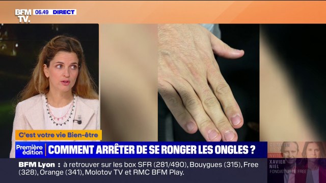 Onychophagie: comment arrêter de se ronger les ongles ?