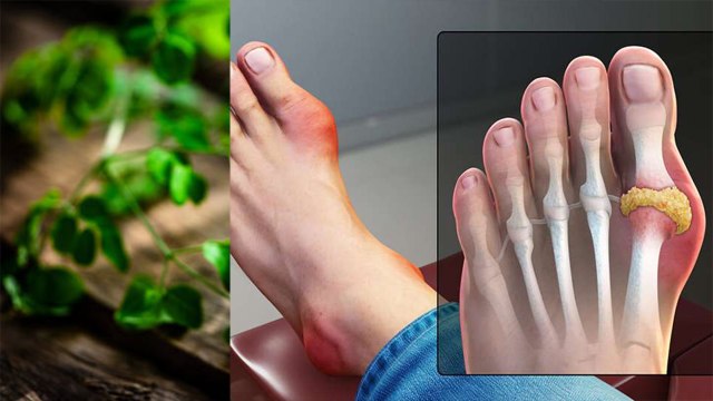 Does Moringa Powder Increase Uric Acid: High Uric Acid Me Moringa Powder Khana Chahiye Ya Nahi |