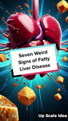 Seven Weird Signs of Fatty Liver Disease