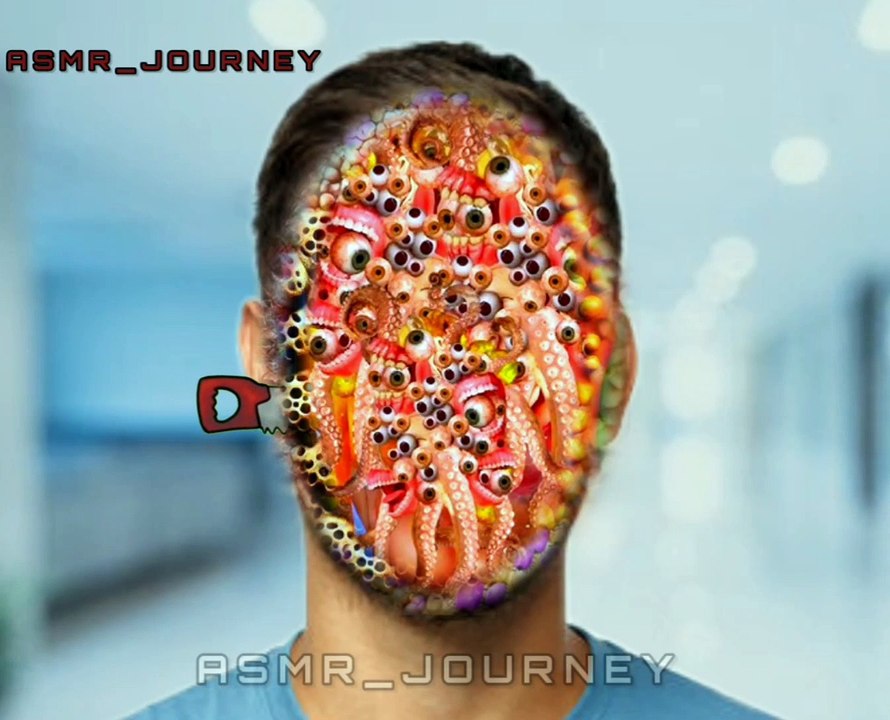 ASMR Tick and Maggot Removal | Calming Extraction Sounds"