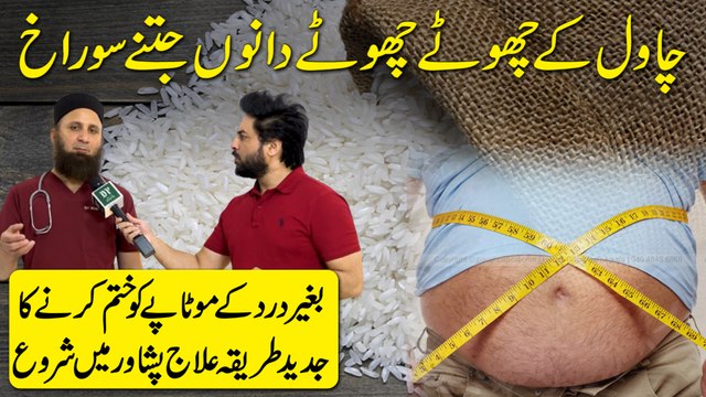 Operation karwa kar mareez khud drive kar k ghar jata hai, baghair kisi dard aur cut k herat angaiz scienci elaj…