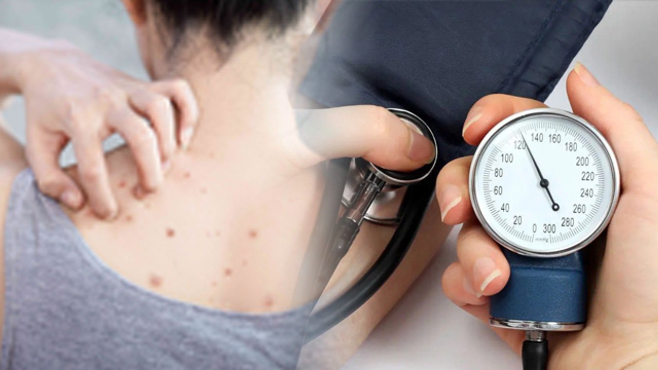 Peeth Par Pimple Kyu Hote Hai | Back Acne Treatment Home Remedies| Boldsky