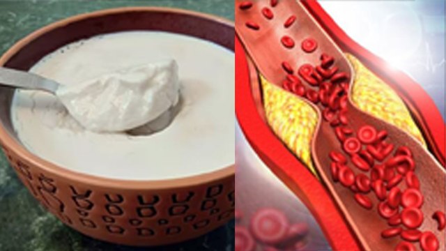 दही खाने से कोलेस्ट्रॉल कम होता है क्या | Dahi Khane Se Cholesterol Kam Hota Hai Kya | Boldsky