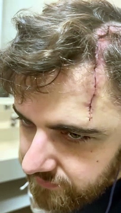 Zé Neto mostra ferimento impressionante