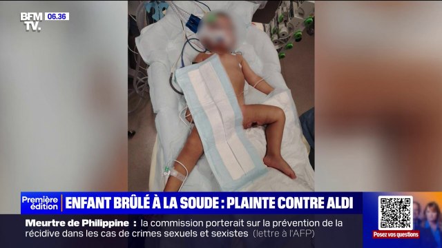 Enfant brûlé à la soude: une plainte déposée contre Aldi France, qui a vendu le produit aux deux mineurs suspects