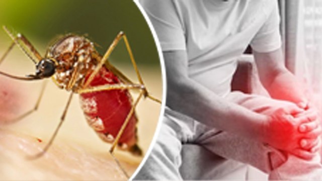 Chikungunya Virus Causes, Symptoms, Joint Pain Treatment In Hindi| Boldsky
