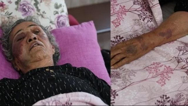 Yemek yiyip çay içtiği akrabasını çekiçle dövüp gasbetti: Mahalleli linç etti